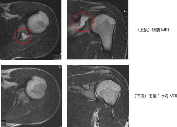 MRI